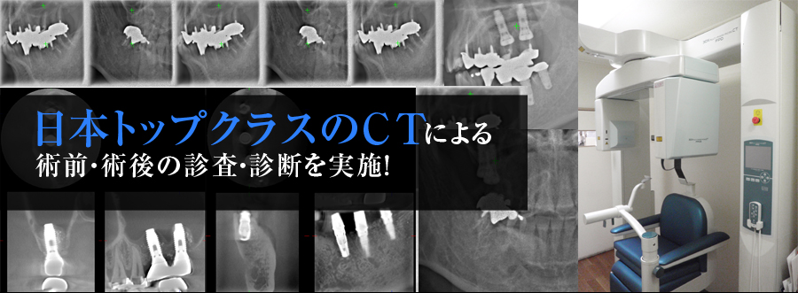 日本トップクラスのCTによる