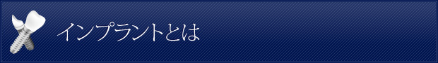 インプラントとは
